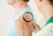 Врач дерматолог-онколог: какие заболевания лечит?