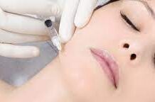 Преимущества контурной пластики