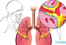 Мокрота: причины возникновения