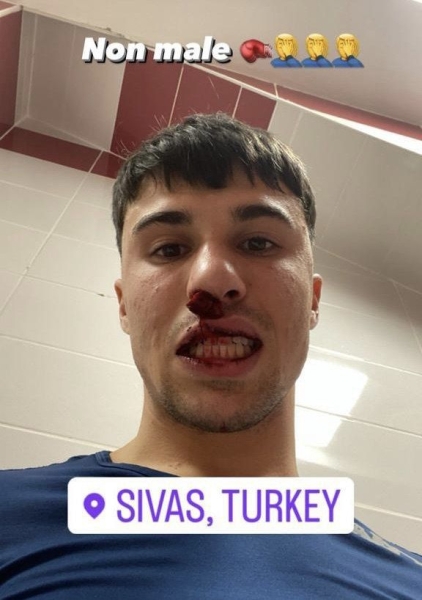 Фанат «Сивасспора» напал на игрока «Фиорентины», ударив его по лицу