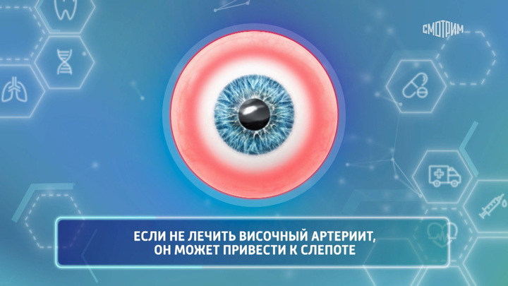 Доктор Мясников назвал причину головной боли