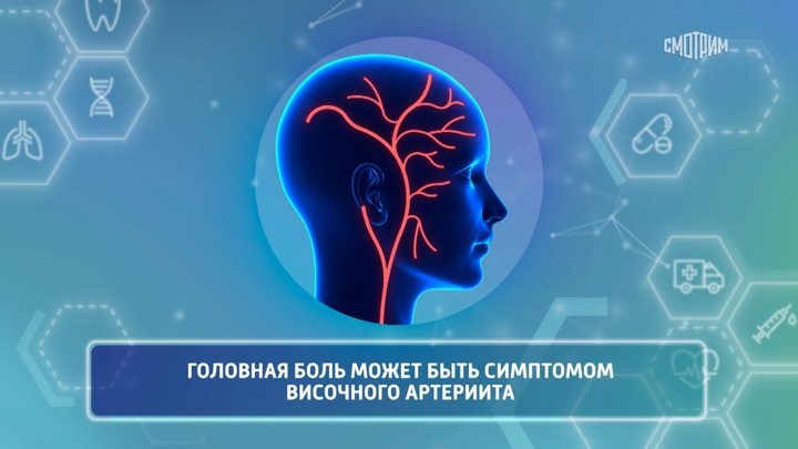 Доктор Мясников назвал причину головной боли
