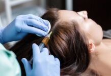 Мезотерапия для волос: Эффективное средство в борьбе за здоровье и красоту волос