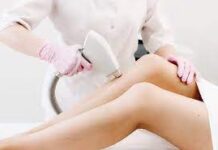 Как подготовиться к лазерной эпиляции