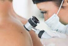 Как быстро получить консультацию дерматолога?