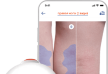 Средства серии Atopic: Поддержка кожи при экземе