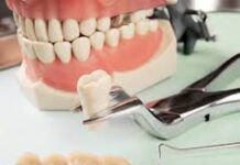 Роль стоматолога-ортопеда в восстановлении зубного ряда