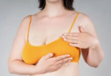 Мастопексия и спортивные нагрузки: как правильно сочетать?