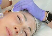 Что такое микроигольчатый лифтинг и кому подойдет процедура