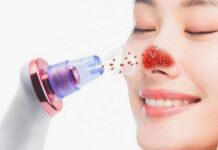 Эффективная и безопасная чистка лица от чёрных точек: методы и советы экспертов