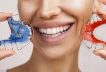 Исправление прикуса: современные методы и подходы к лечению