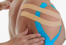 Кинезиотейпирование плечевого сустава: применение, эффективность и рекомендации