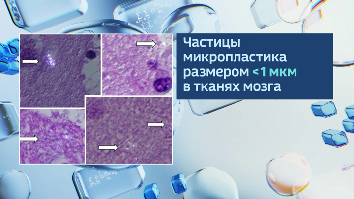 Ученый Золотова: заболевания могут появиться из-за микропластика в организме - Новости на Вести.ru