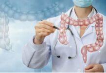 Профилактика и лечение: современные подходы к борьбе с раком ободочной кишки