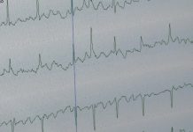 Холтер: как маленький прибор раскрывает тайны сердца — Новости на Вести.ru