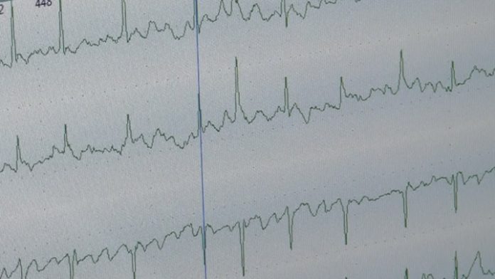 Холтер: как маленький прибор раскрывает тайны сердца — Новости на Вести.ru