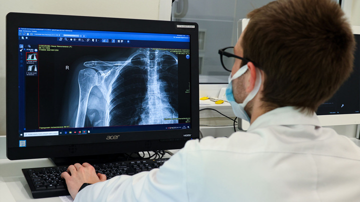 ИИ внедрили для диагностики онкологических заболеваний в Орловской области — Новости на Вести.ru