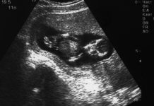 В Республике Алтай все частные клиники отказались от проведения абортов — Новости на Вести.ru