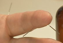 Врач Олейников рассказал, чем опасно иглоукалывание у непроверенных лекарей — Новости на Вести.ru