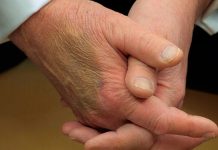 CNN: новые синяки на руке Трампа вызывают вопросы — Новости на Вести.ru