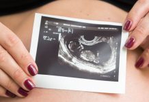 Неинвазивный тест для беременных на аномалии ребенка можно будет сдать бесплатно — Новости на Вести.ru