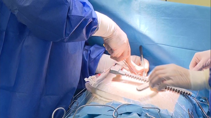 В центре нейрохирургии Бурденко провели почти 11 тысяч операций за год - Новости на Вести.ru